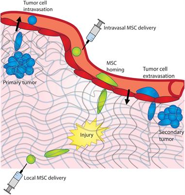 Mechanosensing of Mechanical Confinement by Mesenchymal-Like Cells